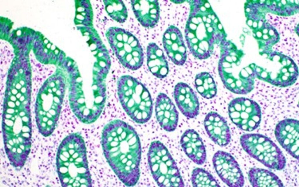 IHC Analysis
